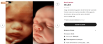 Sur internet, de nombreuses offres commerciales proposent de transformer vos échographies 3D/4D en images ultraréalistes grâce à l'IA. Ici, un exemple de service en ligne vendant cette "numérisation de la première photo de bébé" pour 21,54 €, illustrant la prolifération de ces solutions purement commerciales.
